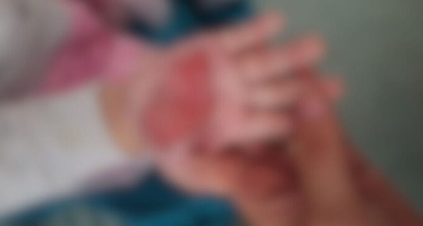 Madrasta choca com crueldade contra criança de apenas dois anos