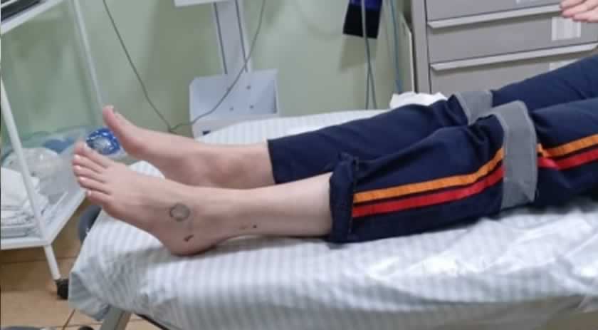 Profissional do SAMU é mordida por cão durante atendimento de mulher armada com faca