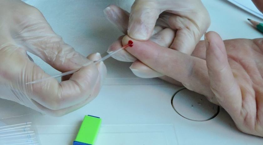 Saúde oportuniza testagem rápida de Hepatite para a população
