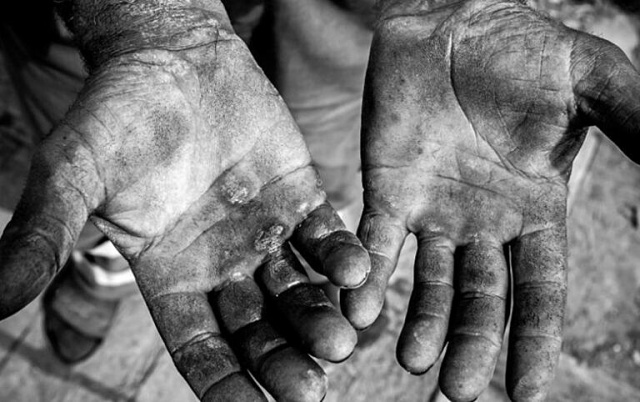 Mais de 2,8 mil pessoas são resgatadas do trabalho análogo à escravidão no país