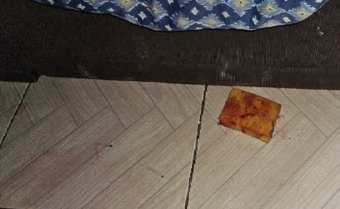 Mulher de 20 anos é espancada pelo marido após voltar da igreja