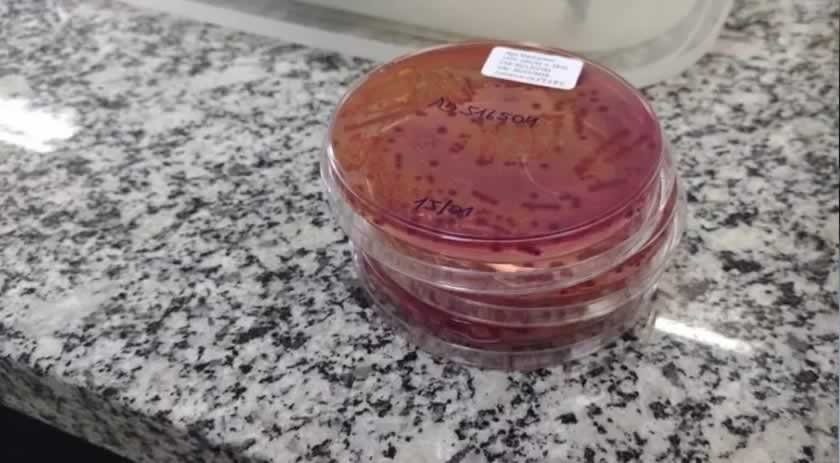 Dez cidades de SC enviarão amostra de água após surto de casos de diarreia