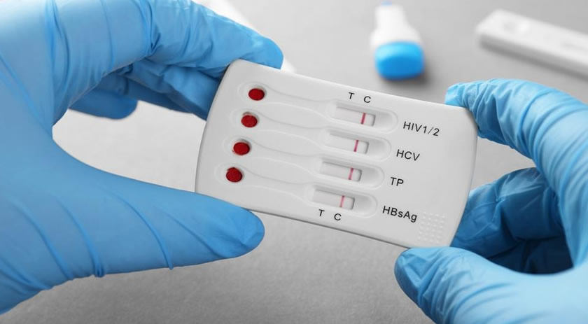 Nova variante do HIV está circulando em três estados do Brasil, diz estudo