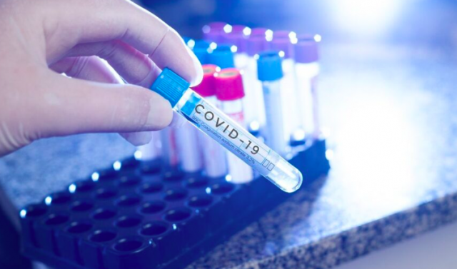 Santa Catarina confirma dois casos da variante XEC da Covid-19