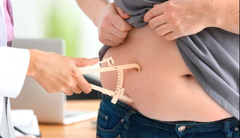 Com novas regras para cirurgia bariátrica, SC tem mais de 400 pessoas na fila do SUS
