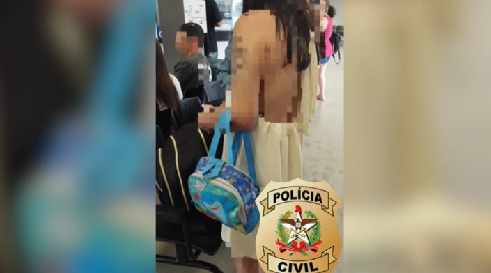 Madrasta acusada de queimar mão de criança com colher quente é presa