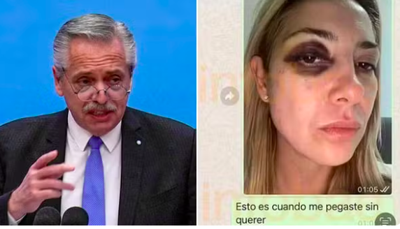 Ex-presidente da Argentina é formalmente acusado por lesões graves contra a ex-mulher