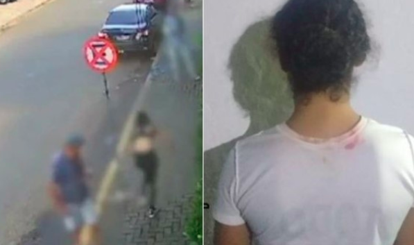 Não era ácido: substância jogada em jovem no PR era soda cáustica; veja o estado de saúde