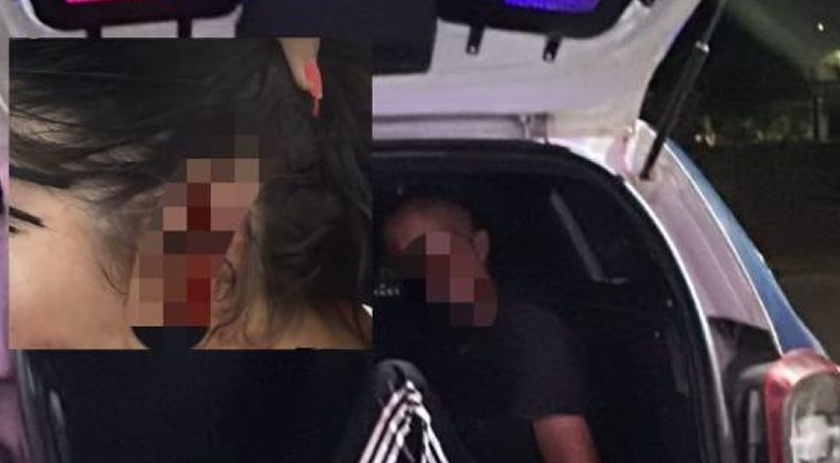 Marido arranca pedaço da orelha da esposa durante briga por ciúmes